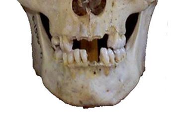 mouth.gif (145652 bytes)