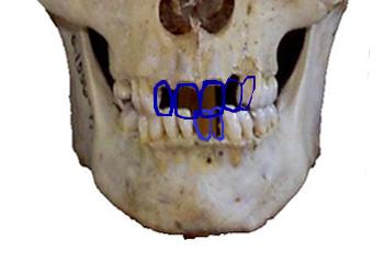 mou02.jpg (10695 bytes)