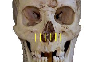 nose1b.jpg (9723 bytes)