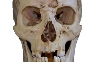 nose_2.gif (90548 bytes)