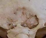 scar~00.jpg (3822 bytes)